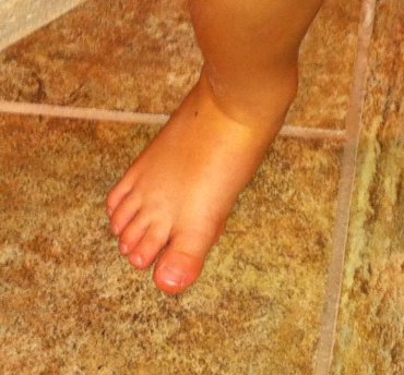 Child's foot
